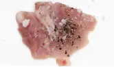 1단계 사진