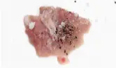 3단계 사진