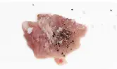 1단계 사진