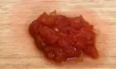 2단계 사진