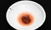 5단계 사진